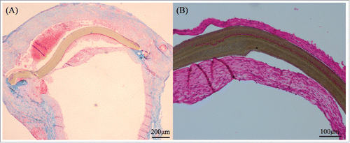 FIGURE 2. (A) This figure was stained by MTC method. A 1-week sample from the control group revealed a clot between the ePTFE patch and its surrounding tissue. (B) After 3 weeks, inflammation cells and native tissue became non-reactive to ePTFE patches.