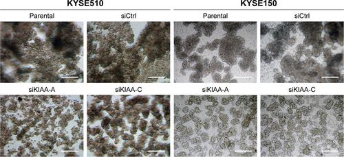 Figure S3 KIAA1522 depletion inhibits cell–cell adhesion.Notes: KYSE150 and KYSE510 cells were transiently transfected with KIAA1522 siRNA or control non-silencing siRNA for 48 h and then seeded on polyHEMA-coated dishes. The cell morphology was observed under the phase. Scale bars =50 μm.Abbreviations: Ctrl, control; polyHEMA, polyhydroxylethylmethacrylate; si, siRNA.