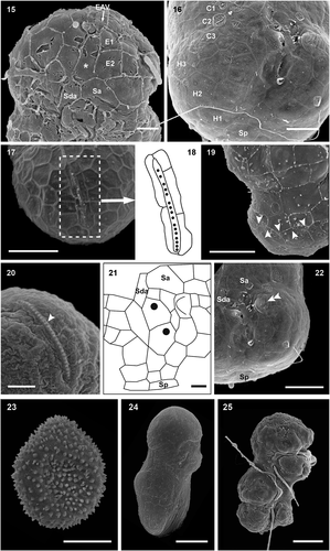 Figs 15–25. Scanning electron micrographs and drawings showing morphological details of cultured A. catalana cells. Fig. 15. Ventral view of the episome reveals the frequently seen elongated AV in contact with the EAV (asterisk) and the consistently detected Sda. Fig. 16. Hyposome and the three rows of AVs. Fig. 17. Apical view of the EAV. Fig. 18. Drawing of the EAV highlights the long central AV ornamented with knobs and the surrounding platelets. Fig. 19. Cingulum of a cell showing the zig-zag line of its lower margin. Fig. 20. EAV and its knobs (arrowhead). Fig. 21. Drawing of the sulcal area. Fig. 22. Sulcal area of a cell, showing a thumb-like protrusion (double arrowhead). Fig. 23. Possible resting cyst. Figs 24, 25. Dividing cells showing oblique division. E = episome; C = cingulum; H = hyposome; EAV = elongated apical vesicle; Sa = anterior sulcal vesicle; Sda = right anterior sulcal AV; Sp = posterior sulcal vesicle; Scale bars=1 µm (Figs 15, 20, 21), 2 µm (Fig. 16), 3 µm (Figs 17, 19, 22) and 5 µm (Figs 23, 24, 25).