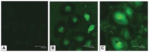 Figure 7 Fluorescent intensity in EC9706 cells observed by confocal fluorescence microscope. (A) ASON, (B) PEI/ASON, (C) NGR/PEI/ASON.Abbreviations: PEI, polyethylenimine; ASON, antisense oligonucleotide; NGR, asparagine-glycine-arginine peptide.