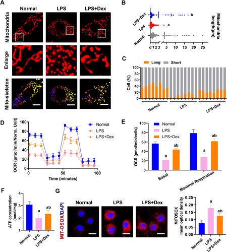 Figure 6 Dexmedetomidine ameliorated mitochondrial fission and function in sepsis. (A) Confocal images to observe mitochondrial morphology of VECs (Bar, 25 µm). (B) The length of mitochondria of VECs in each group. (C) The statistical analysis of mitochondrial morphology of VECs in different groups, n=8. (D and E) Effects of Dex on the mitochondrial respiration in VECs, n=3. (F) Effects of Dex on the level of ATP of VECs after sepsis by the luciferase method, n=3. (G) Representative confocal images of MITO-SOX (Bar, 15µm) in sepsis in VECs, n=3. a: P<0.05 compared with the normal group, b: P<0.05 compared with the LPS group.