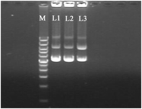 Figure 8. Agarose gel electrophoresis image of c-Myc-siRNA3-pDNAs in acid condition: L1, original c-Myc-siRNA3-pDNAs; L2, c-Myc-siRNA3-pDNAs incubated in pH 4.0 PBS for 2 h; L3, c-Myc-siRNA3-pDNAs incubated in pH 7.0 PBS for 2 h; M, marker.
