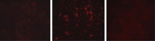 Figure 4 Fluorescence microscopy images of mammary gland slices.Notes: Left, treated with labeled tilmicosin-SLN; middle, injection site; and right, treated with rhodamine B solution.Abbreviation: SLN, solid lipid nanoparticle.