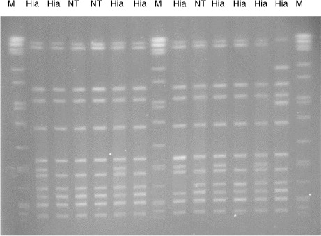 Fig. 1.  Pulsed-field gel electrophoresis of SmaI restricted Haemophilus influenzae DNA. M, Salmonella Braenderup DNA as size marker; Hia, Haemophilus influenzae serotype a; NT, non-typeable Haemophilus influenzae.
