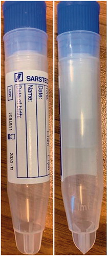 Picture 1. Saliva collection tubes.