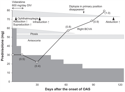 Figure 3 Time course of ocular symptoms and signs after onset of orbital apex syndrome. After onset, the amount of steroid was increased from betamethasone 4 mg, and the converted amount of prednisolone was 26–60 mg. Ocular movement, visual acuity, and ptosis gradually improved thereafter. Vidarabine was also given for 12 days after the onset of orbital apex syndrome.