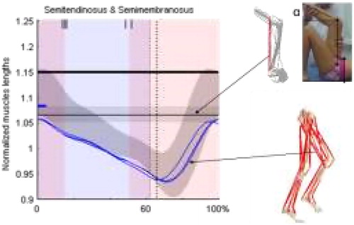 Figure 1. Illustration of the data inputted in the SiMusCP procedure. After a model personalisation, the functional hamstring length is modelled on the basis and of the clinical gait analysis measures and the clinical maximum hamstring length is computed using the clinical measurement α (bilateral popliteal angle). Those lengths are respectively compared to decision thresholds (the small bold blue hyphen and the horizontal bold line). If both are under those thresholds hamstring lengthening indication is proposed to the surgeon.