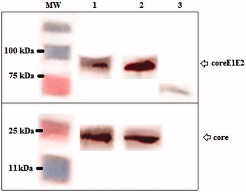 Figure 2. Western blot analysis using an anti-His monoclonal antibody showed the expression of the full-length core (Lane 1 and 2, ∼21 kDa), and coreE1E2 (Lane 1 and 2, ∼83 kDa) proteins using TurboFect and MPG, respectively. Any detectable band was not observed in untransfected cells as a negative control (Lane 3).