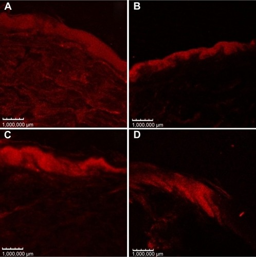 Figure 7 Confocal micrograph images of porcine ear skin after 8 hours treatment with (A) LP20, (B) LP80, (C) SP80, and (D) SP20 with Nile red fluorescent dye. Fluorescence images recorded with 559 nm excitation and 636 nm emission wavelengths.Abbreviations: LP20, soybean lecithin and polysorbate 20; LP80, soybean lecithin and polysorbate 80; SP20, sorbitan monooleate and polysorbate 20; SP80, sorbitan monooleate and polysorbate 80.