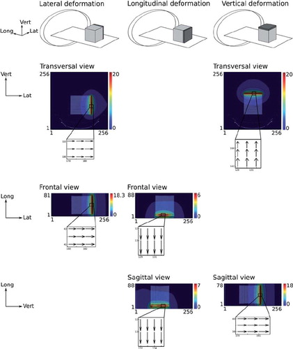 Figure 1. Illustration of the process of validating the MATLAB program's interpretation of image metrics, comparing DIRs between CT scans of phantom blocks of water equivalent material extending a base block of 20 cm × 20 cm × 20 cm in lateral, longitudinal and vertical directions by 2 cm. Here the deformation vector lengths are displayed in colour contour-plots overlying the corresponding CT images in transversal, frontal and sagittal image planes as required to verify axis orientation. In figures showing the transversal imaging plane the horizontal axis shows lateral pixel value and the vertical axis shows vertical pixel value (note that the TPS rescales the 512 × 512 pixels CT images to 256 × 256 pixels when performing the DIR). In figures showing the frontal or sagittal imaging planes the horizontal axis shows lateral and vertical pixel values respectively, whereas the vertical axis shows CT slice number, corresponding to the longitudinal direction. Displacement vector directions are shown as an insert under all figures, verifying correct MATLAB representation of DVFs (shown here for expansion, i.e. base→enlarged phantom image).