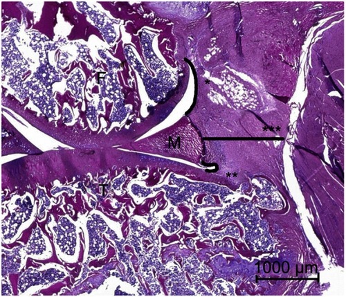 Figure 2 Morphometrical parameters in a HE-stained section in the sagittal plane: *postero superior synovial length between the meniscus and the femur-synovial junction; **posteroinferior synovial length between the meniscus and the tibia–synovial junction; ***capsule thickness between the posterior border of the meniscus and the muscle layer.