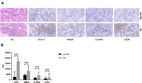 Figure 5 H&E and immunohistochemical analysis (A) of STAT1, MNDA, IL10RA, and CCR1 proteins in minor salivary gland biopsy (MSGB) staining from 14 SS patients and 14 non-SS patients (magnification: ×200 for H&E staining and ×200 for IHC). Blue marks the nucleus, and brown marks the target protein. The bar graph indicated medians with interquartile ranges of IOD value (B). ***P<0.001.