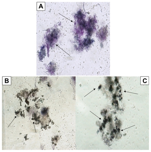 Figure 3 Microscopic views of the effects of silver nanoparticles (Ag-NPs) on metabolic activity of Leishmania tropica promastigotes in the dark: (A) parasites in the control group (not exposed to Ag-NPs), (B) the cytopathic effects of Ag-NPs at 150 μg/mL, and (C) the cytopathic effects of Ag-NPs at 200 μg/mL. Arrows in (A) indicate the formation of formazan crystals and in (B) and (C) indicate the clusters of Ag-NPs (magnification 40×).