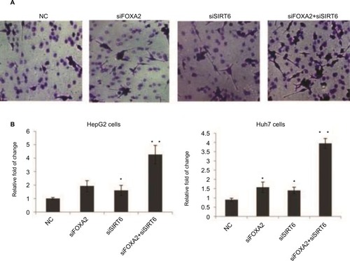 Figure 4 FOXA2 and SIRT6 suppress HCC cells invasion in vitro.Notes: (A) The effects of FOXA2 or/and SIRT6 knockdown on invasion ability of HepG2 cells in vitro were examined by Transwell assay, and representative images are shown. (B) The statistical analysis was shown, and the data were represented as mean ± SD. *P<0.05, **P<0.01. (C) The above Transwell assay was performed in Huh7 cells, and the statistical analysis is shown.Abbreviations: HCC, hepatocellular carcinoma; SIRT, sirtuin; NC, negative control.