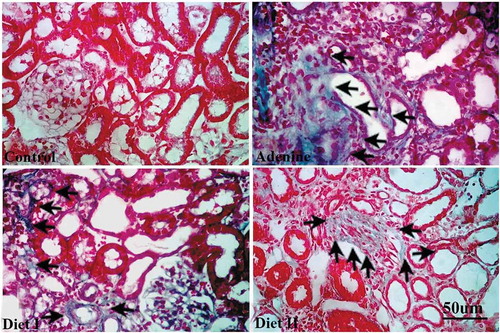 Figure 4. Representative photographs showing collagen deposition (arrows) in masson trichrome stained kidney sections isolated from (a) control group, (b) adenine group, (c) diet I group (Persea Americana fruit 50% w/w in diet), and (d) diet II group (Persea Americana fruit 100% w/w diet)