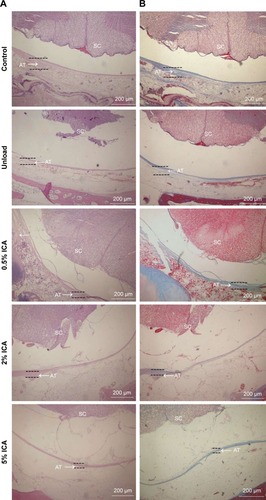 Figure 10 Histological micrographs of different PCL–gelatin membrane groups with H&E (A) and Masson (B) staining after laminectomy for 4 weeks.Notes: Scale bar =200 μm. Arrows indicate the adhesion tissue.Abbreviations: AT, adhesion tissue; ICA, icariin; PCL, polycaprolactone; SC, spinal cord.