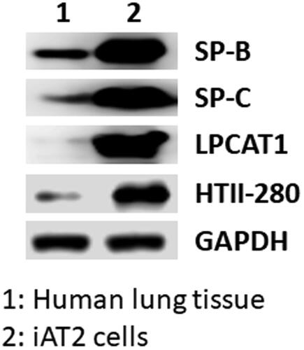Figure 1. Expression of alveolar epithelial cell type 2 markers in iAT2 cells derived from human iPSC. Each specific protein was detected by western blotting. Normal human lung tissue was used as the positive control (Lane 1). iAT2 cells expressed both surfactant proteins B and C, confirming differentiation (Lane 2). LPCAT1, Lysophosphatidylcholine Acyltransferase 1; HTII-280, 280–300 kDa protein specific to apical surface of AT2 cells; SP-B, Surfactant Protein B; SP-C, Surfactant Protein C.