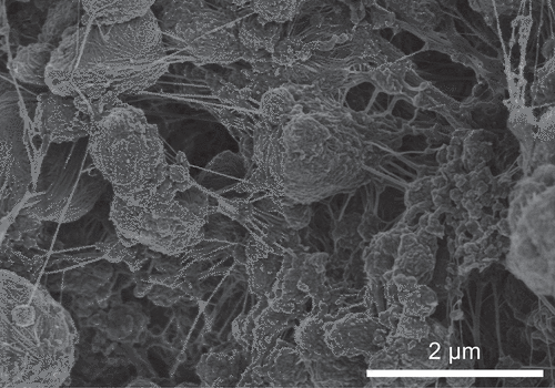 Figure 2. SEM image of polyethylene obtained by silver catalyst (Table 1, run 8).