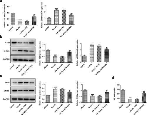 Figure 2. LPAR5 deletion improved the endothelium dysfunction of HUVECs triggered by ox-LDL. (a) CD31 and α-SMA mRNA expression levels after LPAR5 silencing in ox-LDL-induced HUVECs were tested with RT-qPCR. (b) Evaluation of CD31 and α-SMA protein expression with western blotting. (c) Detection of iNOS and eNOS protein expression by means of western blot analysis. (d) The secretion of NO was analyzed with commercially available kit. ***P < 0.001 vs. control; ##P < 0.01, ###P < 0.001 vs. ox-LDL+si-NC