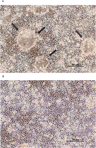 Figure 2. The effect of tumor necrosis factor-α on Calu-3 domes. Phase contrast image of (A) control cell layers and (B) collapse of domes in cell layers treated with 150 ng/ml TNF-α for 24 hr. Black arrows indicate domes. Calu-3 cell layers were seeded onto round 1.5 cm diameter glass coverslips and photographed at 100X magnification using a Nikon Diaphot inverted phase contrast microscope. Bar = 50 µm.