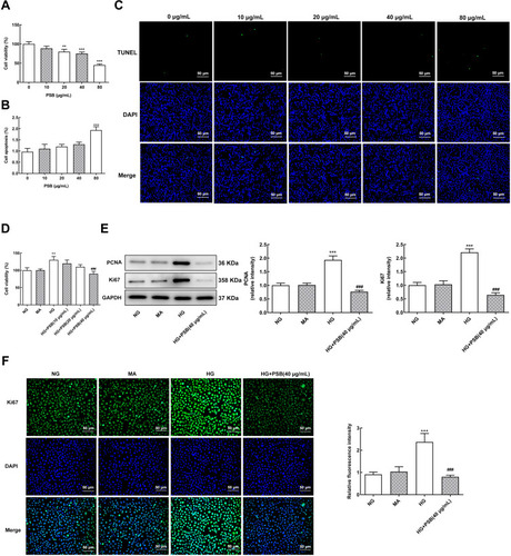 Figure 1 The effect of PSB on HG-enhanced HRVECs proliferation. (A) The cell viability of HRVECs that exposed to 0, 10, 20, 40 and 80 μg/mL PSB was determined using a CCK-8 kit. (B and C) Cell apoptosis was evaluated with TUNEL staining. **P<0.01 and ***P<0.001 vs 0 μg/mL PSB. (D) The cell viability of HRVECs that cultured in NG, MA, HG or HG plus PSB (10, 20, 40 μg/mL) was examined by a CCK-8 kit. (E) The protein expression of PCNA and Ki67 in HRVECs that cultured in NG, MA, HG, and HG plus PSB (40 μg/mL) was assessed by Western blot analysis. (F) Representative images of immunofluorescence staining for Ki67 (green), blue represents the nuclei which were stained with DAPI (x200). **P<0.01 and ***P<0.001 vs NG; ###P<0.001 vs HG.