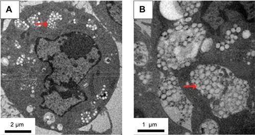 Figure 6 Bio-TEM images of KCs treated with PEI@PMMA NPs.Notes: (A) Bio-TEM images of KCs treated with PEI@PMMANPs (10000×). (B) Bio-TEM images of KCs treated with PEI@PMMANPs (20000×). The red arrows indicate the location of PEI@PMMA NPs in the KCs.Abbreviations: KCs, Kupffer cells; NPs, nanoparticles; PEI, polyethyleneimine; PMMA, poly(methyl methacrylate); TEM, transmission electron microscopy.