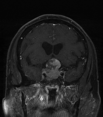 Figure 2. The ‘Snowman’ sign