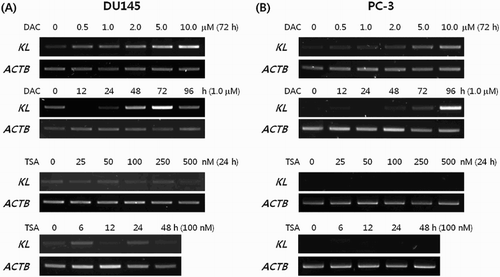 Figure 3. Restoration of the KLOTHO mRNA by treatment with either DAC or TSA in prostate cancer cell lines DU145 and PC-3, respectively.