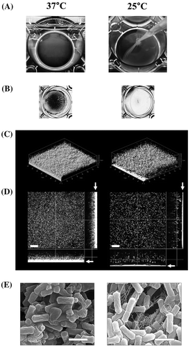 Fig. 2. The images show different biofilm structures of C. perfringens under different temperatures.Notes: Left panels 37 °C. Right panels 25 °C. (A) Pellicle biofilm formation at 25 °C. (B) Crystal violet staining of surface-attached biofilms. (C and D) Confocal reflection microscopy images (scale bar, 20 μm). (E) Scanning electron microscopy images of the biofilms (scale bar, 2 μm). Image is reprinted from ref 26. Copyright © 2014, American Society for Microbiology [Journal of bacteriology, 196, 2014, 1540–1550, doi:10.1128/JB.01444-13].
