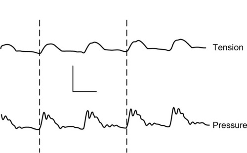 Figure 4 Simultaneous recording of tension (upper) and blood pressure (lower) from the rabbit aorta in vivo.