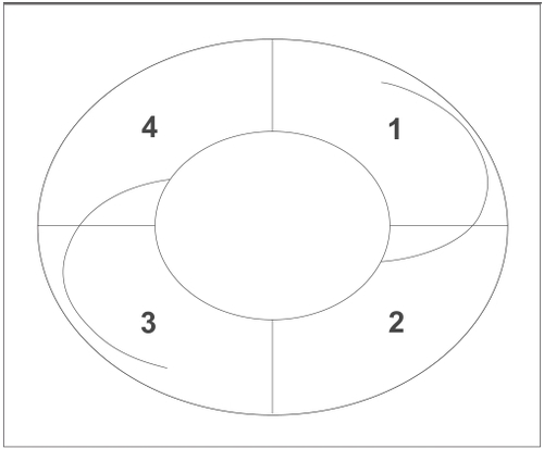 Figure 4 Note the area around the optic divided in four different quadrants (1,2,3,4), each of them evaluated separately according to the intensity of Sommering’s ring (SRI). The mean SRI was calculated by the formula MSRI = [(SRI1) + (SRI2) + (SRI3) + (SRI4)]/4.