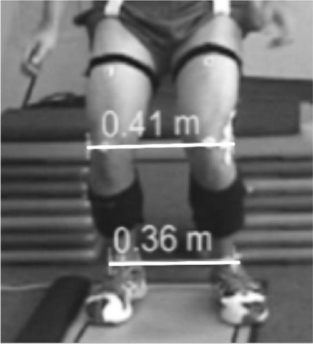 Figure 2 KASR defined as the ratio of distance between lateral femoral epicondyles (knee) and lateral malleoli (ankle) (KASR = knee/ankle) during peak knee flexion.