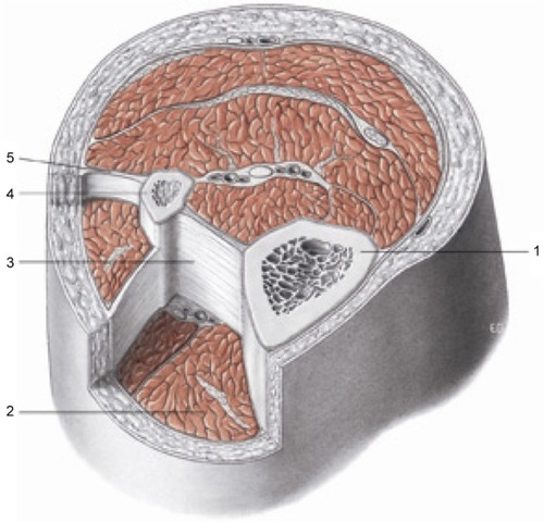 Figure 1 Transverse section at the level of the upper third of the leg. The fascia is the philosophy of the body, meaning each body region is connected to another, whereas osteopathy is the philosophy of medicine: the entire human body must work in harmony. Reproduced with permission anastasi et al. AA VV, anatomia dell’uomo, 4 ed, Edi.ermes, Milano [Human anatomy].Citation114