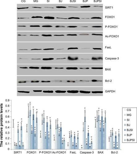 Figure 5 Western blot analysis of the protein levels of SIRT1, FOXO1, phosphorylated FOXO1 (P-FOXO1), acetylated-FOXO1 (Ac-FOXO1), FasL, and caspase-3.