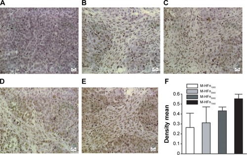Figure 7 Representative images of immunohistochemical staining of MDA-MB-231 tumor tissues by incubating with M-HFn nanoparticles (DAB as the substrate).Notes: (A) Without M-HFn nanoparticle incubation. Incubated with (B) M-HFn1000, (C) M-HFn3000, (D) M-HFn5000, and (E) M-HFn7000. (F) Different density mean shows that the tissue sections treated with M-HFn nanoparticles of larger core sizes enhance the efficiency of immunohistochemical staining (P<0.05).Abbreviations: M-HFn, ferrimagnetic H-ferritin; DAB, 3,3′-diaminobenzidine tetrahydrochloride.