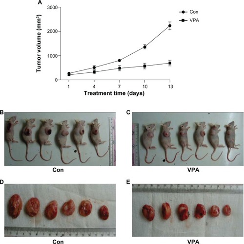Figure 2 Inhibition of Kasumi-1 xenograft tumor growth by valproic acid. (A) Curve chart demonstrated a significant difference in tumor growth between control arm and valproic acid group after two weeks of treatment. Data are shown as the mean ± standard error of the mean. (B and C) Comparison of the nude mice with xenografts between the control group and the valproic acid group. (D and E) Comparison of tumor size after sacrifice of the mice.