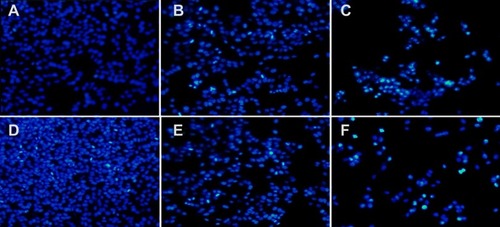 Figure S2 CDDP/OA-LCC NPs induces apoptosis in HepG2 cells. Hoechst 33,258 nuclear staining cell apoptosis images. (A) Control; (B) CDDP-Sol; (C) CDDP-LCC NPs; (D) OA-Sol; (E) OA-LCC NPs; (F) CDDP/OA-LCC NPs.Abbreviations: CDDP, cisplatin; OA, oleanolic acid; LCC, lipid coated calcium carbonate; NP, nanoparticles.