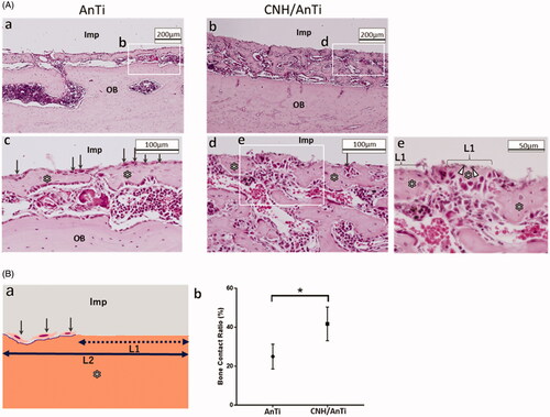 Figure 6. Bone regeneration by using AnTi and CNH/AnTi. A. Histological observations with an optical microscope at 7 d after surgery. (a,c) AnTi group showing (a) lower and (c) higher magnification images. (b,d,e) CNH/AnTi group showing (b) lower and (d) higher magnification images, and (e) highest-resolution image corresponding to the white box in (d). “Imp” indicates areas with removed AnTi or CNH/AnTi. OB: original bone. “*”: newly-formed bone. White arrowhead: black spots of CNHs. B. (a) Schematic representation of L1 and L2 for the estimation of the Bone Contact Ratio (BCR) estimated as the length ratio of L1/L2. L1 was the length where new bones directly contacted Ti. L2 was the length where fibrous tissue, fibroblast and osteoblast existed between the new bones and Ti. (b) BCR at 7 d after surgery for AnTi and CNH/AnTi. (n = 4, the five sections were selected randomly and a total of twenty areas in each sample were assessed. *p < .05).