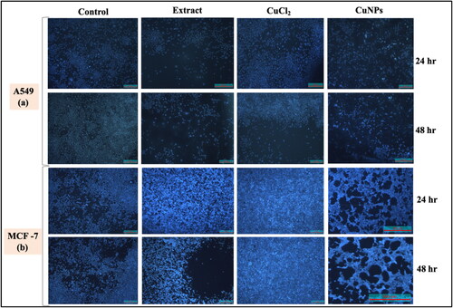 Figure 13. DAPI staining of (a) A549 after 24 and 48 h and (b) MCF-7 after 24 and 48 h.