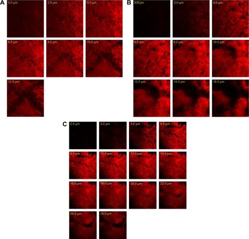 Figure 10 Confocal laser scanning micrographs of the rabbit corneas after instillation of RhB loaded in an aqueous solution (A), OIG (B) and L3 (C) formulations.Abbreviations: OIG, optimized in situ gel; RhB, Rhodamine B; L3, selected lyophilized formula.