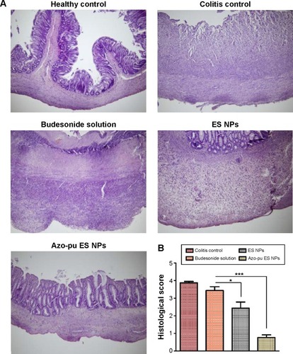 Figure 3 Histological evaluation of colon tissue from the colitis control and budesonide-treated groups.Notes: Representative microphotographs of healthy control, rats not treated with TNBS; colitis control, rats treated with TNBS; budesonide solution, colitis rats treated with budesonide in solution form, ES NPs, colitis rats treated with budesonide-loaded ES NPs; Azo-pu ES NPs, colitis rats treated with budesonide loaded Azo-pu ES NPs administered by oral gavage. (A) Hematoxylin and eosin staining for microscopic evaluation of the colon sections isolated from healthy control, colitis control, and budesonide-treated groups. Images of tissues are shown with 100× magnification. (B) Histological score of the colitis control and budesonide-treated groups. Data are presented as means ± standard deviation (n=3 animals/group). Azo-pu ES NPs showed statistically significant differences (*P<0.05, ***P<0.001) compared to the colitis control.Abbreviations: NPs, nanoparticles; ES, Eudragit S100; Azo-pu, azo-polyurethane; TNBS, 2,4,6-trinitrobenzenesulfonic acid.