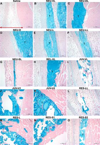 Figure 5 Alcian blue staining at 1 and 4 weeks after subcutaneous injection of the saline control (A), NEU series (B–G), BEL-VL (H), JUV series (I–K), and RES series (L–O). The NEU and BEL fillers were distributed evenly throughout the subcutis as large homogeneous pools of HA material, whereas the JUV and RES fillers tended to agglomerate into smaller pools. The red arrow indicates the location of the subcutaneous tissue. Daggers indicate the presence of an amorphous basophilic substance (the injected HA gel) stained in blue. All images are shown at the same magnification (× 100).