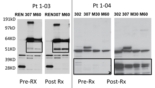 Figure 3. Antitumor humoral immune responses. Extracts from four different mesothelioma cell lines were separated by PAGE, transferred to nitrocellulose, and immunoblotted with diluted (1:1500) sera obtained from two malignant pleural mesothelioma patients (1–03 and 1–04) before and 6-weeks after the initiation of GC1008-based immunotherapy. Black boxes highlight increase reactivity as observed in samples obtained in the course of GC1008-based immunotherapy.