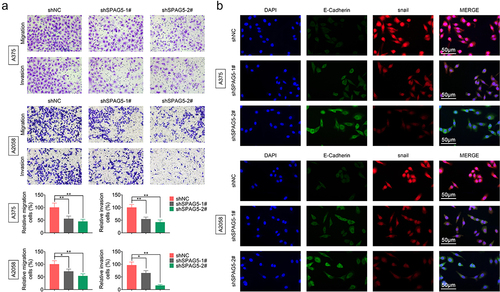 Figure 3. Deletion of SPAG5 expression repressed cell migration and EMT in MM. A375 and A2058 cells were transfected with shNC, shSPAG5-1 and shSPAG5-2, and submitted to (a) transwell assay to detect cell migration and invasion, and (b) immunofluorescence staining of E-cadherin and Snail. (n = 3, *P < 0.05, **P < 0.01).