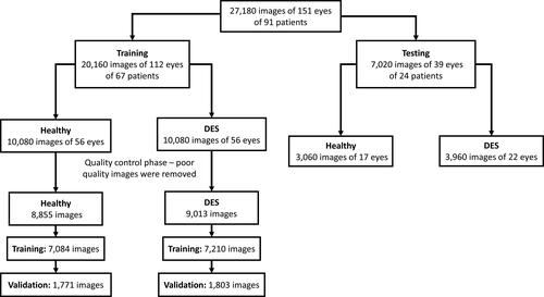 Figure 2 Flowchart of the distribution of images throughout the training and testing of the deep learning model, including the quality control phase and grouping of images within the healthy and dry eye disease groups.