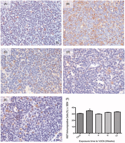 Figure 2. Effect of inhaled vanadium on the percentage of Ki67 immunopositive lymphocytes in female mice. Representative figures are presented. (A) Control mouse spleen shows Ki-67 nuclear signal in a low percentage of lymphocytes. (B) After 1 week of exposure, the percentage of Ki-67+ lymphocytes significatively increased (compared to control) After 4, 8 and 12 weeks of exposures, the percentage of immunopositives lymphocytes did not significantly increase (C, D, E and F) (*p < 0.05 ANOVA, Tukey’s post-hoc test). Ki-67 signal was only seen in nuclear areas in both control and exposed mice.
