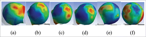 Figure 6. von Mises stress diagram in the articular surface of the hip joint. (A) von Mises stress diagram in the articular surface of the hip joint with the θCE = 50° and α = 0°; (B) von Mises stress diagram in the articular surface of the hip joint with the θCE = 40° and α = −30°; (C) von Mises stress diagram in the articular surface of the hip joint with the θCE = 30° and α = −40°; (D) von Mises stress diagram in the articular surface of the hip joint with the θCE =30° and α = −50°; (E) von Mises stress diagram in the articular surface of the hip joint with the θCE = 20° and α =10°; (F) von Mises stress diagram in the articular surface of the hip joint with the θCE = 10° and α = −60°.