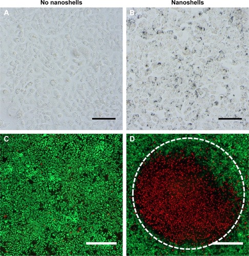 Figure 2 Evaluation of the impact of photothermal therapy on SUM149 cells.Notes: Top: Silver staining reveals nanoshells bound to cells; (A) cells without nanoshells, (B) cells with nanoshells. Scale bar =150 μm. Bottom: Only cells exposed to both nanoshells and light displayed increased membrane permeability, evidenced by red EthD-1 fluorescence. Green fluorescence indicates viable cells with an intact membrane; (C) cells without nanoshells + near-infrared (NIR) light, (D) cells with nanoshells + NIR light. Within (D), cells outside the light exposed region indicated by the white dotted line remain viable confirming nanoshells alone are safe. Scale bar =500 μm.