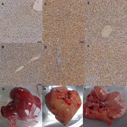 Figure 3 (A–B) Effect of DPP4i treatment on liver DPP4 expression in NC group (×200); (C–D) Effect of DPP4i treatment on liver DPP4 expression in NAFLD-C group (×200); (E–F) Effect of DPP4i treatment on liver DPP4 expression in NAFLD-T group (×200); (G) Gross specimens of NC group, (H) Gross specimens of NAFLD-C group, (I) Gross specimens of NAFLD-T group.