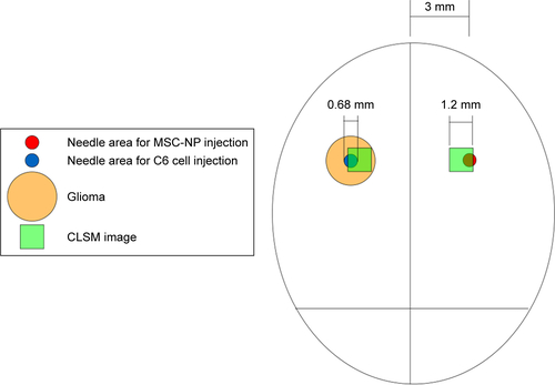 Figure S1 C6 implantation and MSC-NP therapeutic injection (cross-section).Note: Confocal laser-scanning microscopy of CM-Dil-stained MSC NPs in glioma and therapeutic injection site recorded 2 days after MSC-NP injection.Abbreviation: MSC NP, mesenchymal stem cells loaded with paclitaxel poly(d,l-lactide-co-glycolide) nanoparticles.